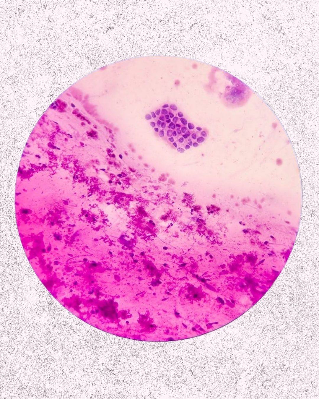 FERTILYSIS Female Microbiome