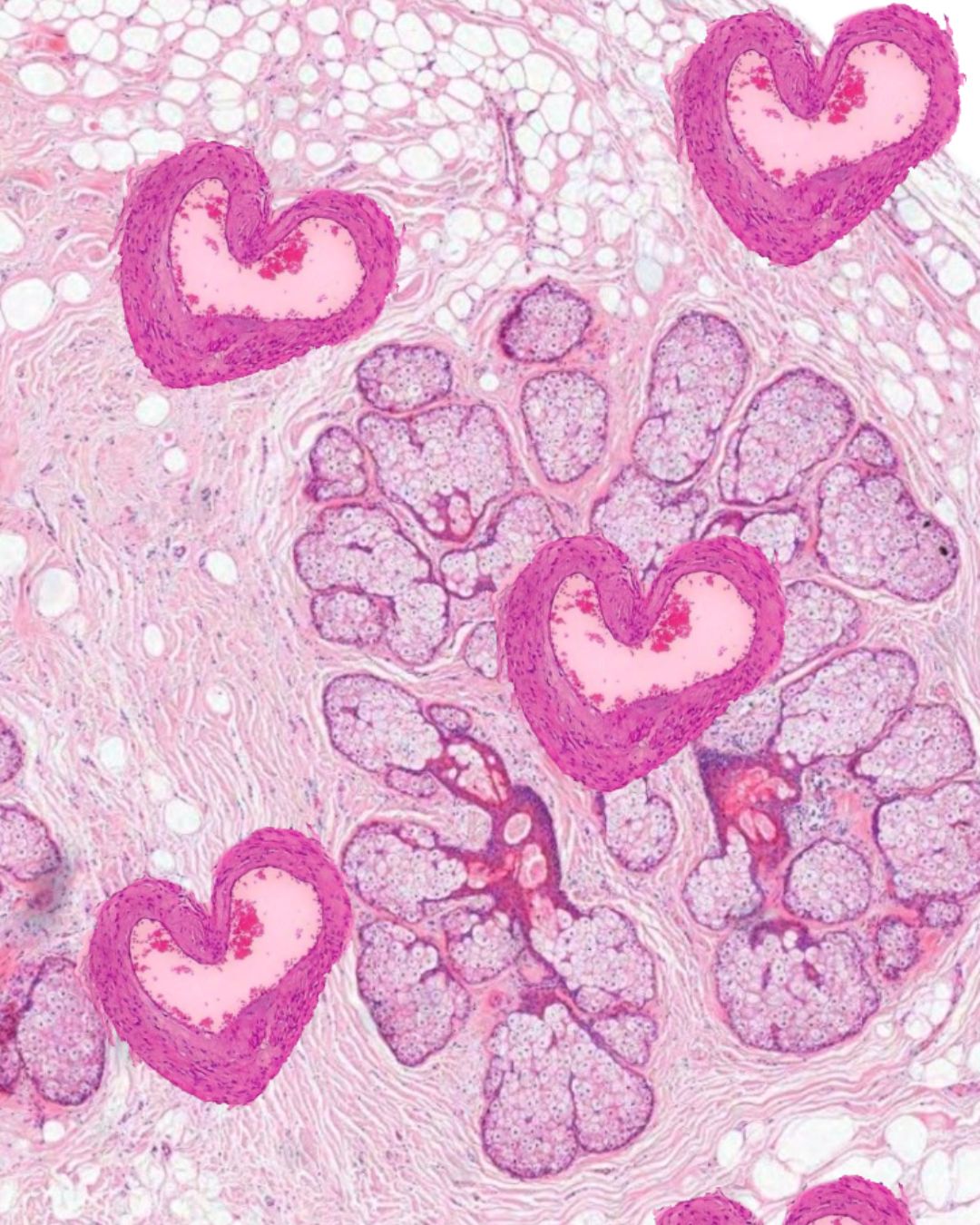 FERTILYSIS RPL panel