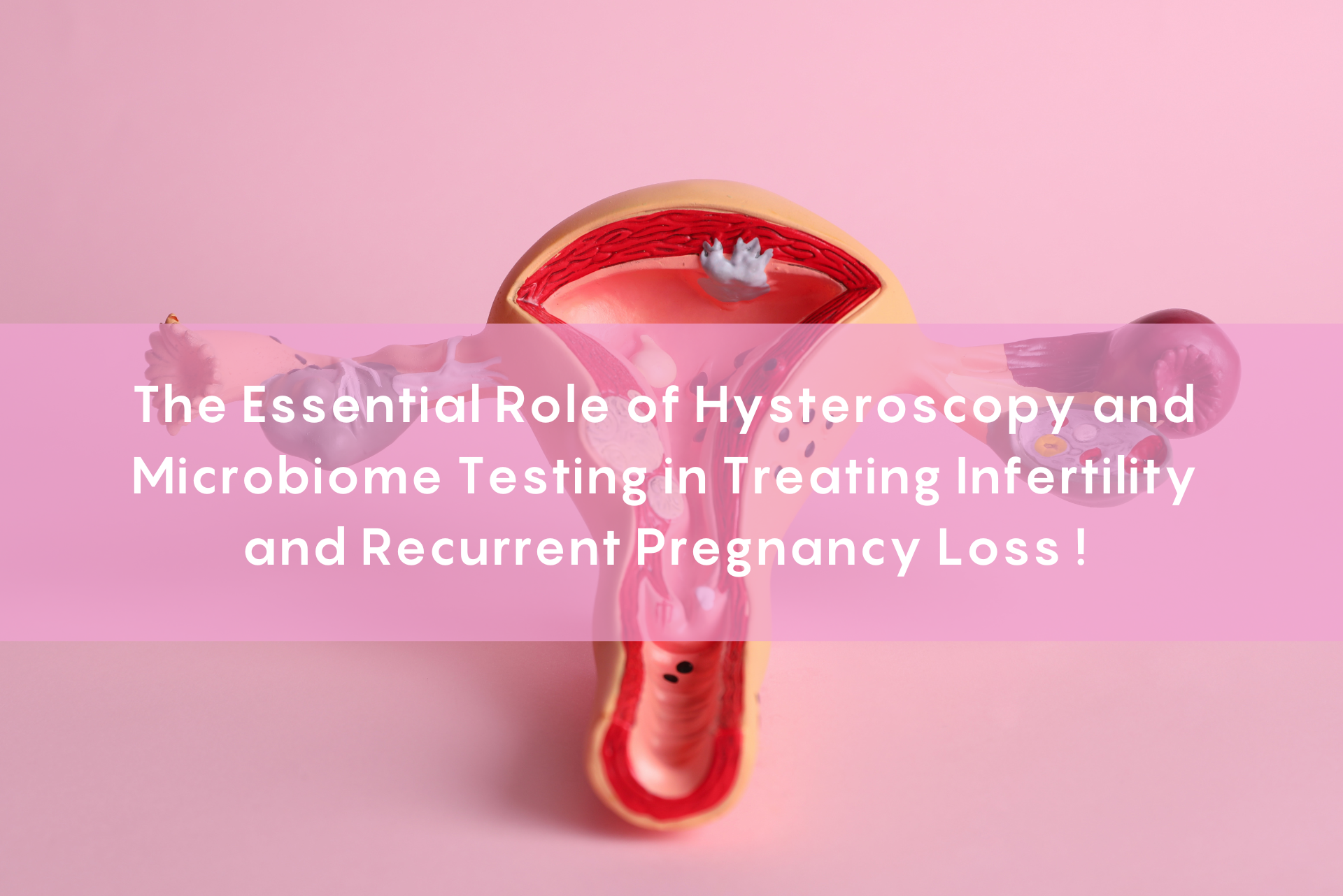 A medical illustration of a uterus with surrounding structures on a pink background, overlaid with the text "The Essential Role of Hysteroscopy and Microbiome Testing in Treating Infertility and Recurrent Pregnancy Loss!" in white font with a semi-transparent pink banner.